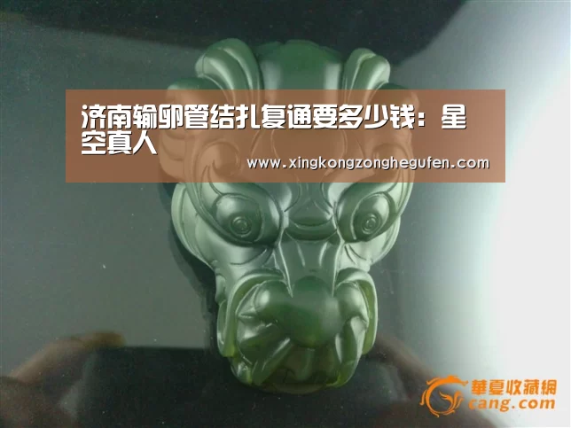 济南输卵管结扎复通要多少钱:星空真人(图2) 星空真人直播