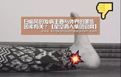白癜风的发病主要与外界的哪些因素有关?【星空真人集团官网】(图2) 星空真人官网
